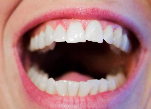 口の中が酸っぱい時に考えられる7つの原因と病気の兆候