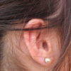 耳の下が痛い原因と対処する方法6つ