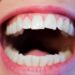 口の中が酸っぱい時に考えられる7つの原因と病気の兆候