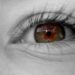 眼底出血が起こる病気の原因と対処法5つ