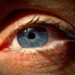 眼球の腫れの原因と症状別の6つの対処法