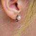 耳管狭窄症の気になる症状と改善するための5つの対処法